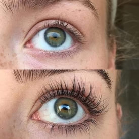 Suero de crecimiento rápido de pestañas y cejas